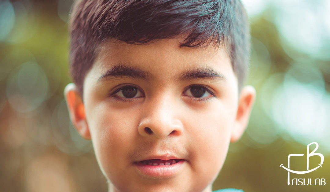 Qué cirugías necesita un niño con labio y paladar hendido?