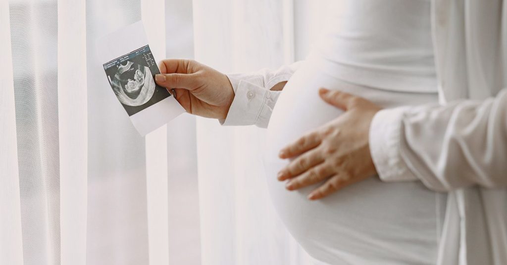 Por qué un niño puede nacer con labio fisurado